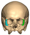 Figure 47