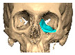 Figure 49