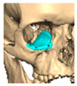 Figure 50