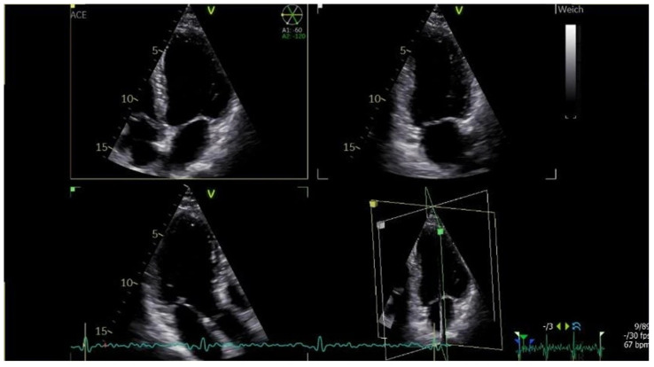 Figure 4