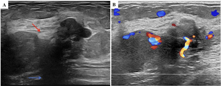 Figure 2