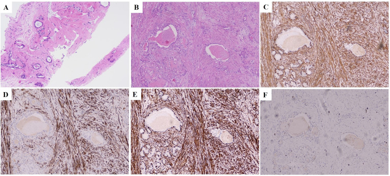 Figure 4