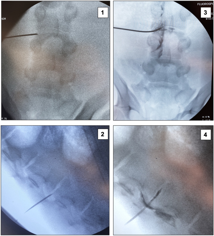 Fig 2