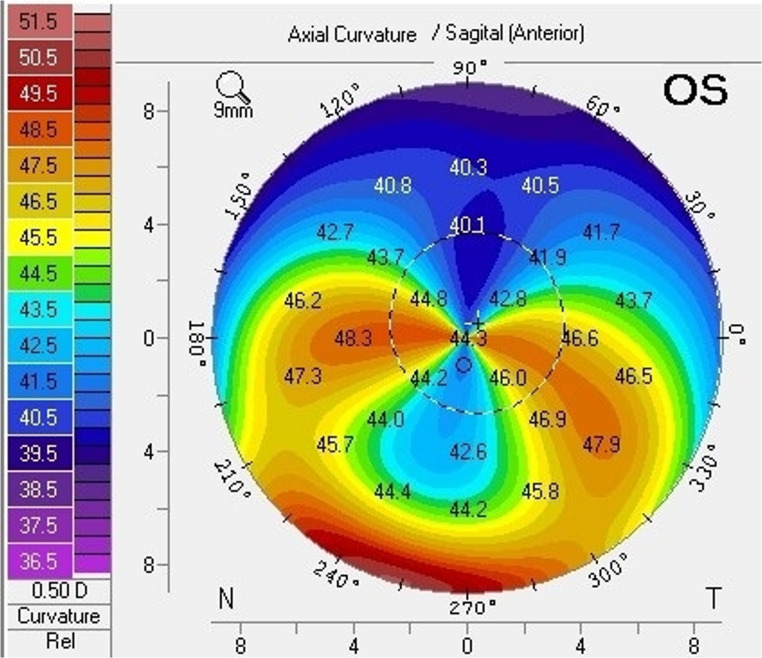 Figure 2