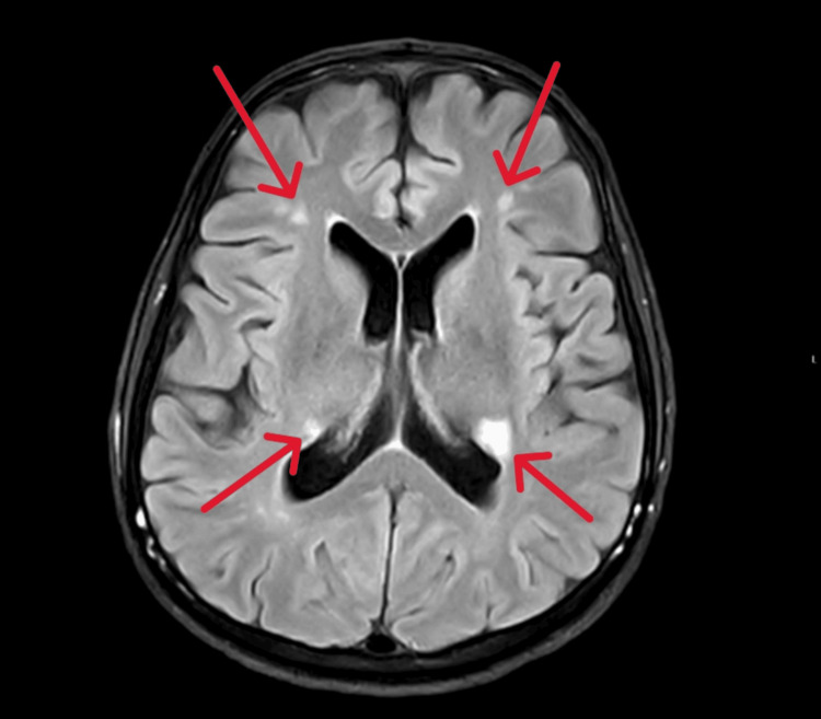 Figure 5