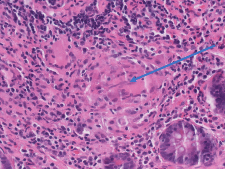 Figure 5