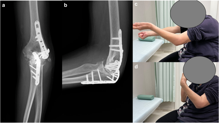 Figure 4