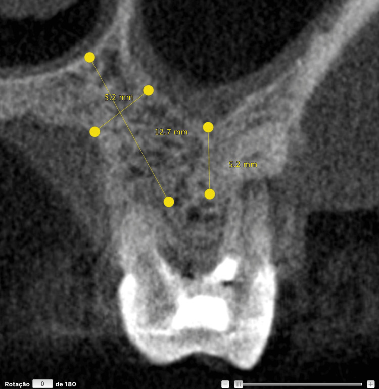 Figure 10