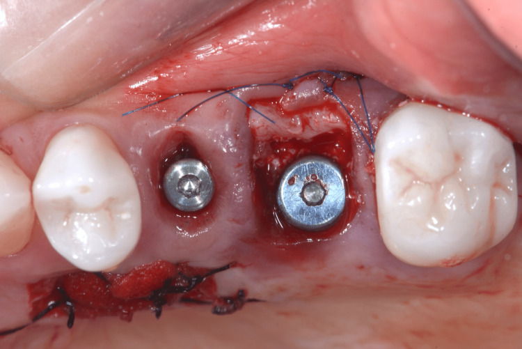 Figure 13