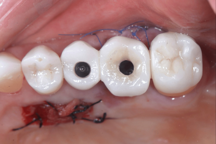 Figure 14