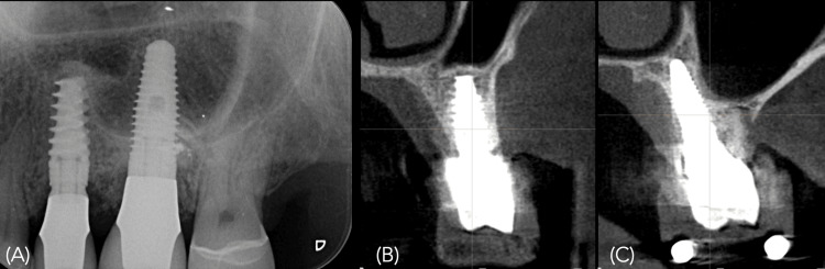 Figure 16