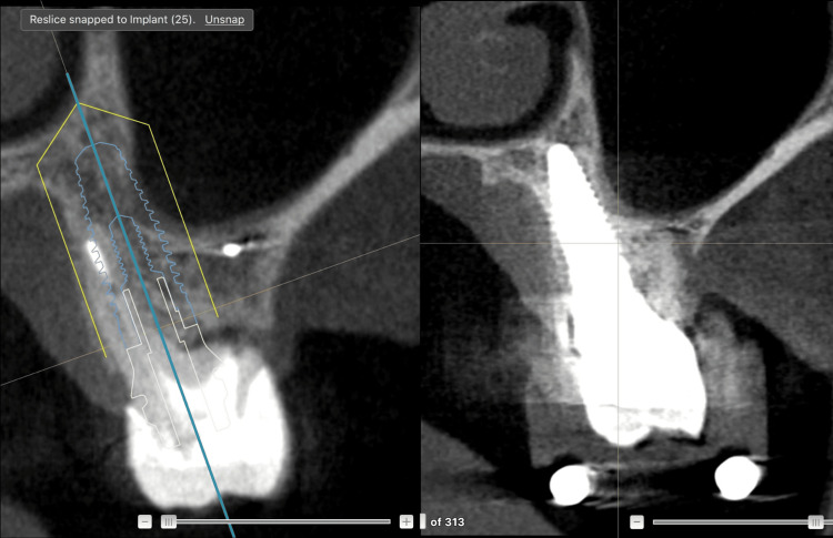 Figure 17