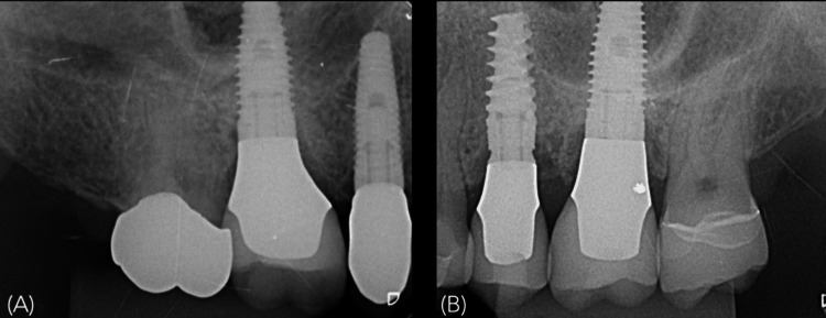 Figure 18