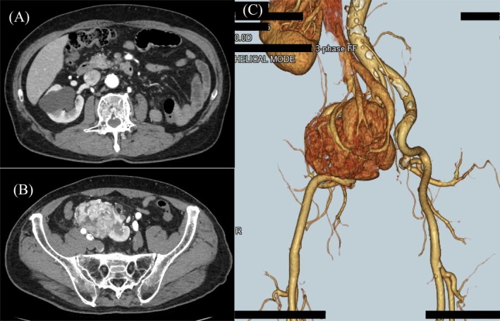 FIGURE 1