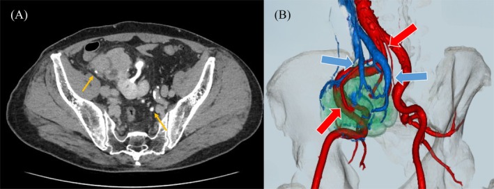 FIGURE 2