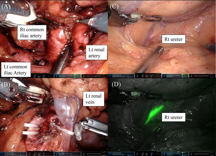 FIGURE 3