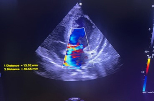 Figure 1b