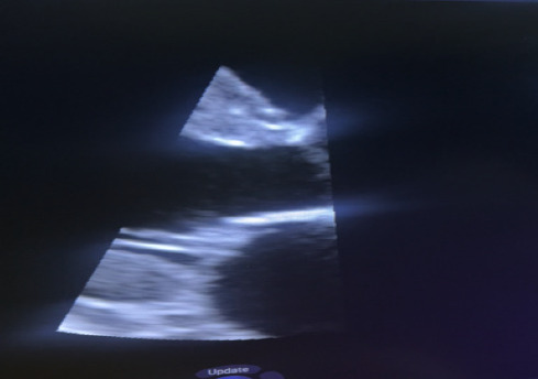 Figure 1c
