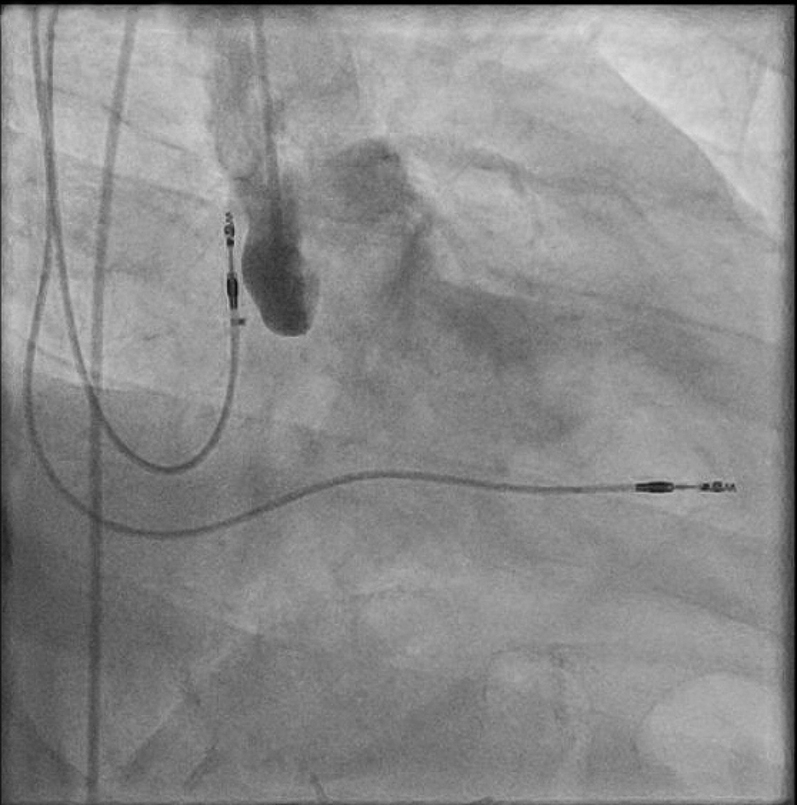 Figure 9
