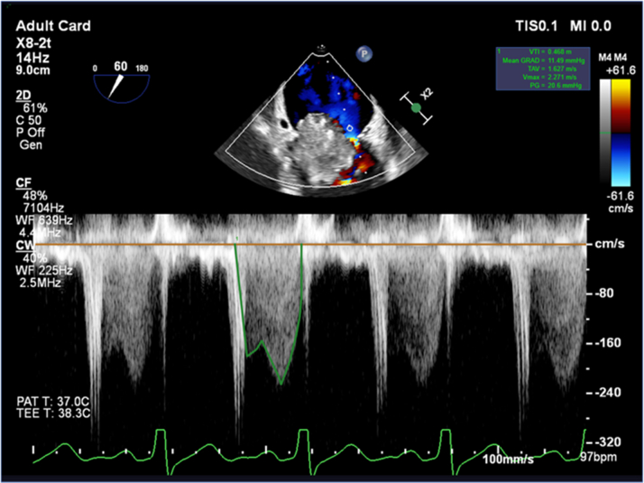 Figure 4