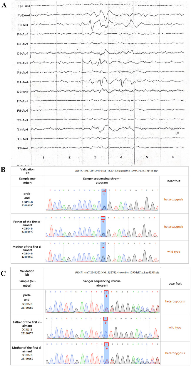 Figure 1