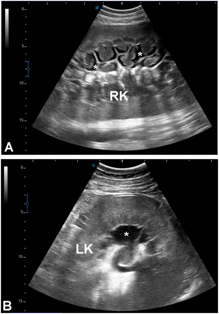 Figure 9