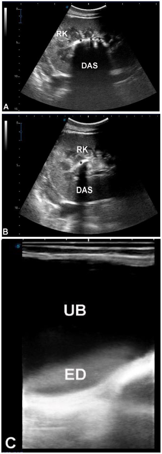 Figure 11