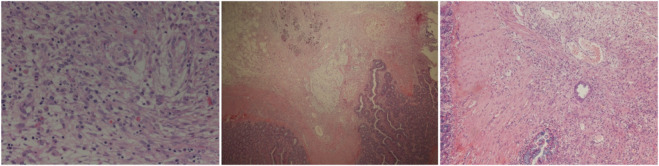 FIGURE 12