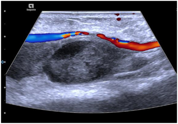 Figure 2