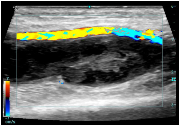 Figure 3