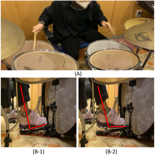 Figure 2