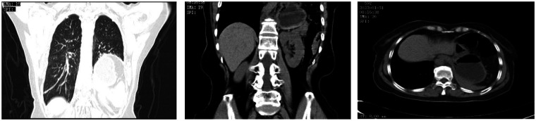 Figure 1