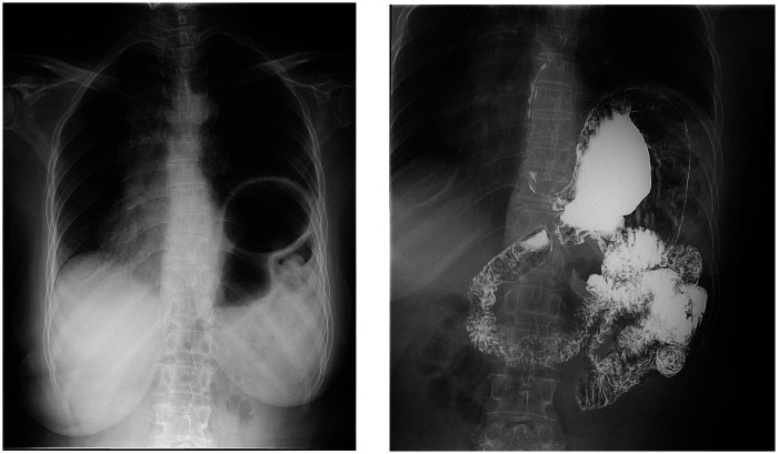 Figure 3