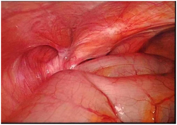 Figure 6