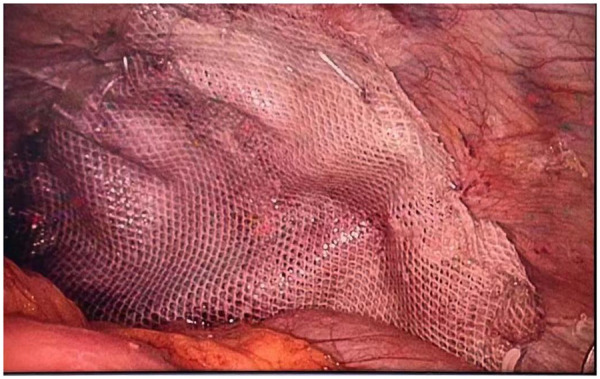 Figure 9