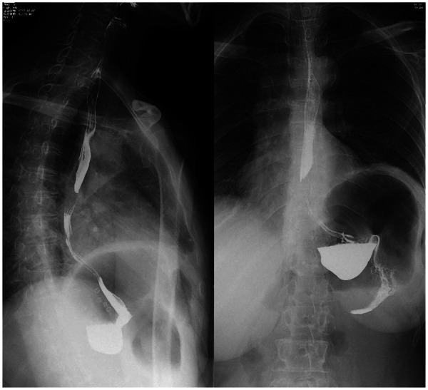 Figure 12