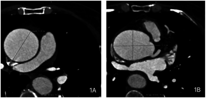 Figure 1
