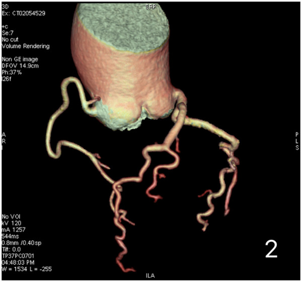 Figure 2