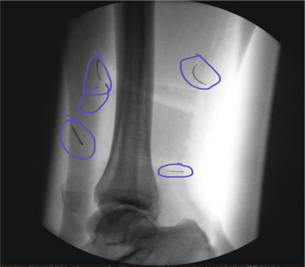 Figure 5