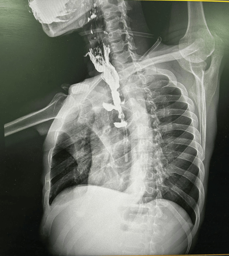 Figure 11