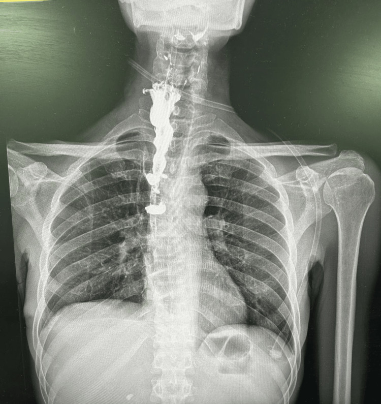 Figure 12