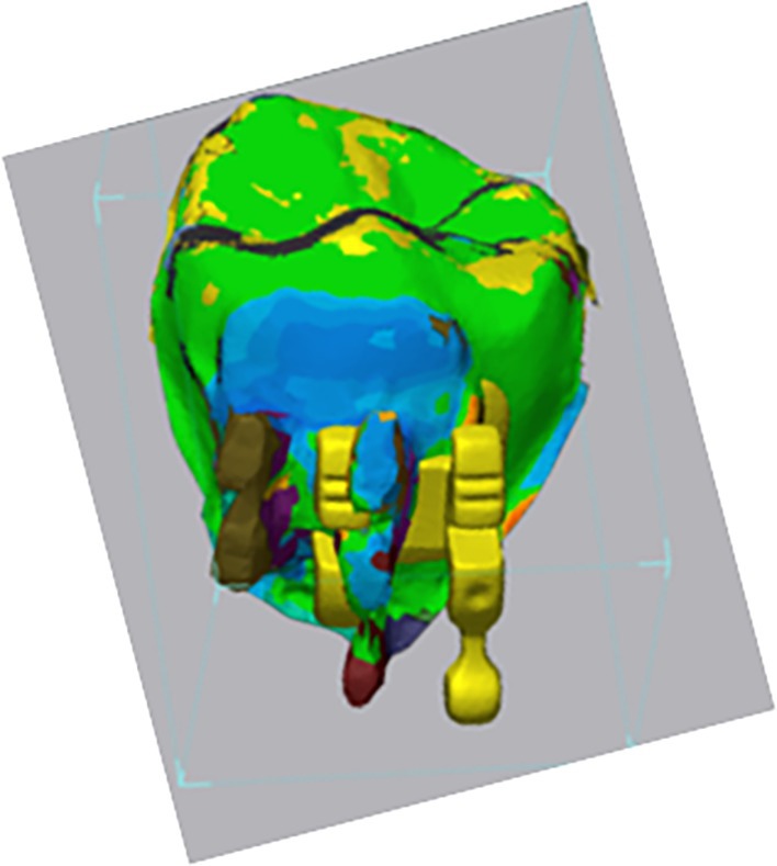 FIGURE 2