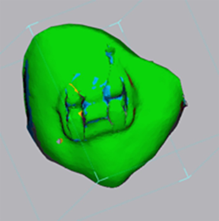 FIGURE 1