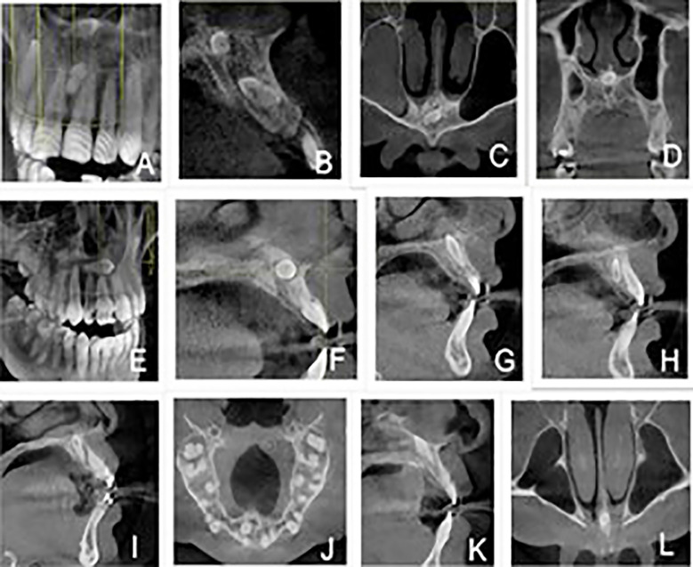 Fig.1