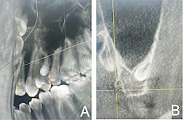 Fig.2
