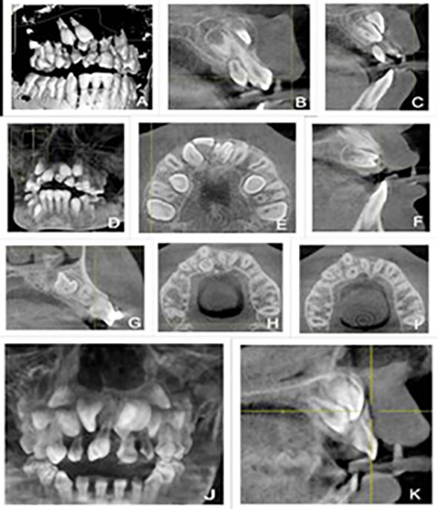 Fig.3