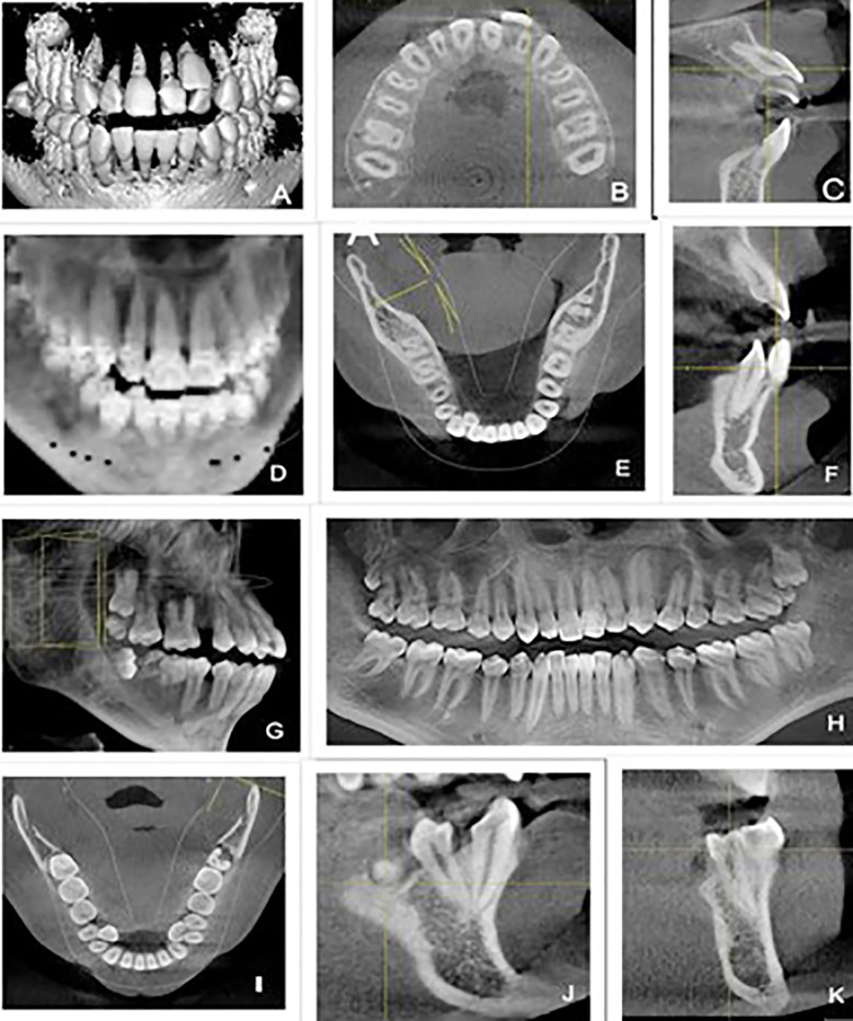 Fig.4