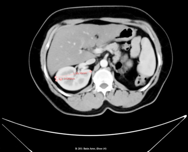 Fig.2