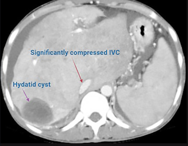 Fig.2