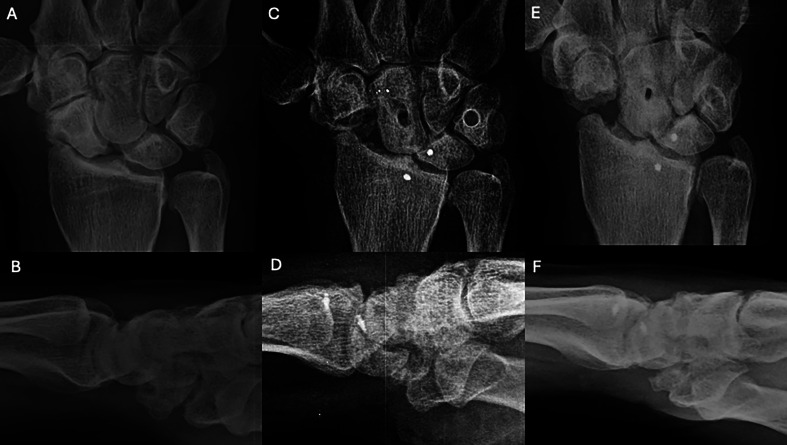 Figure 6